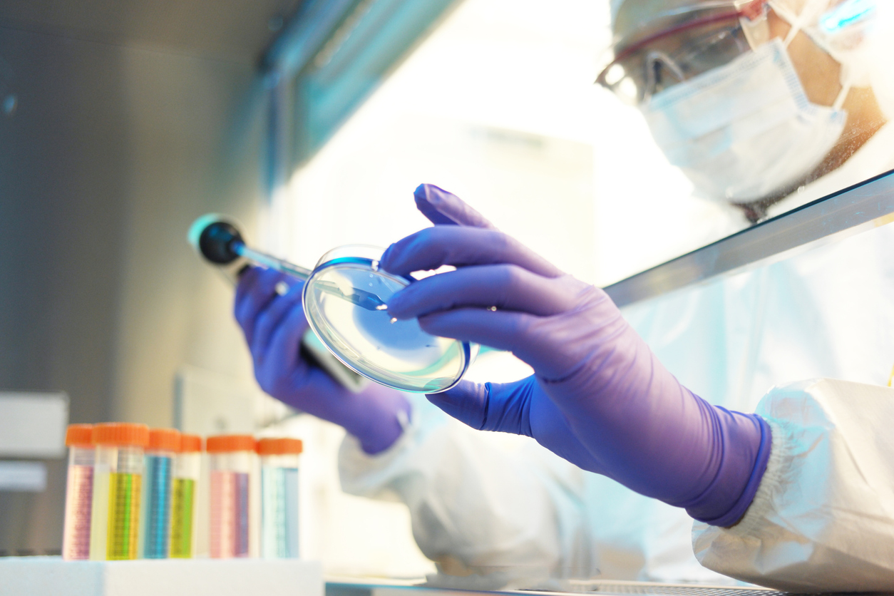 A lab scientist looking at samples on an agar plate